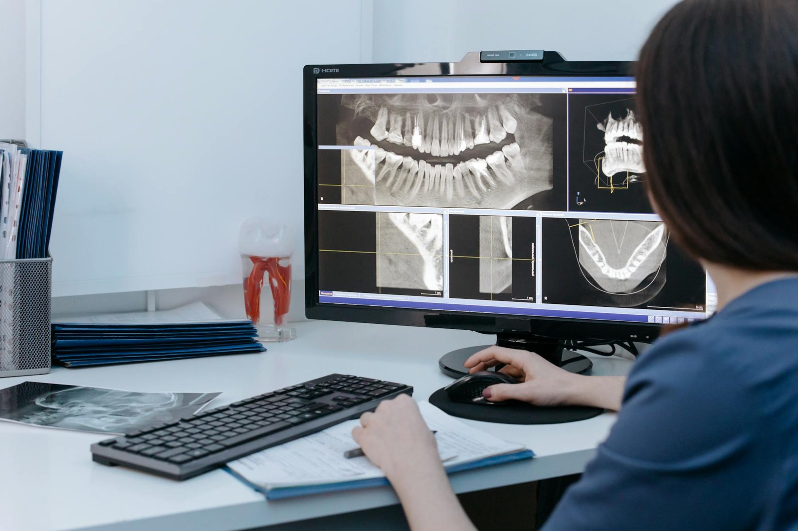 Illustration of Dental Xray Hyderabad: Must-Have Oral Health Imaging for Best Diagnosis