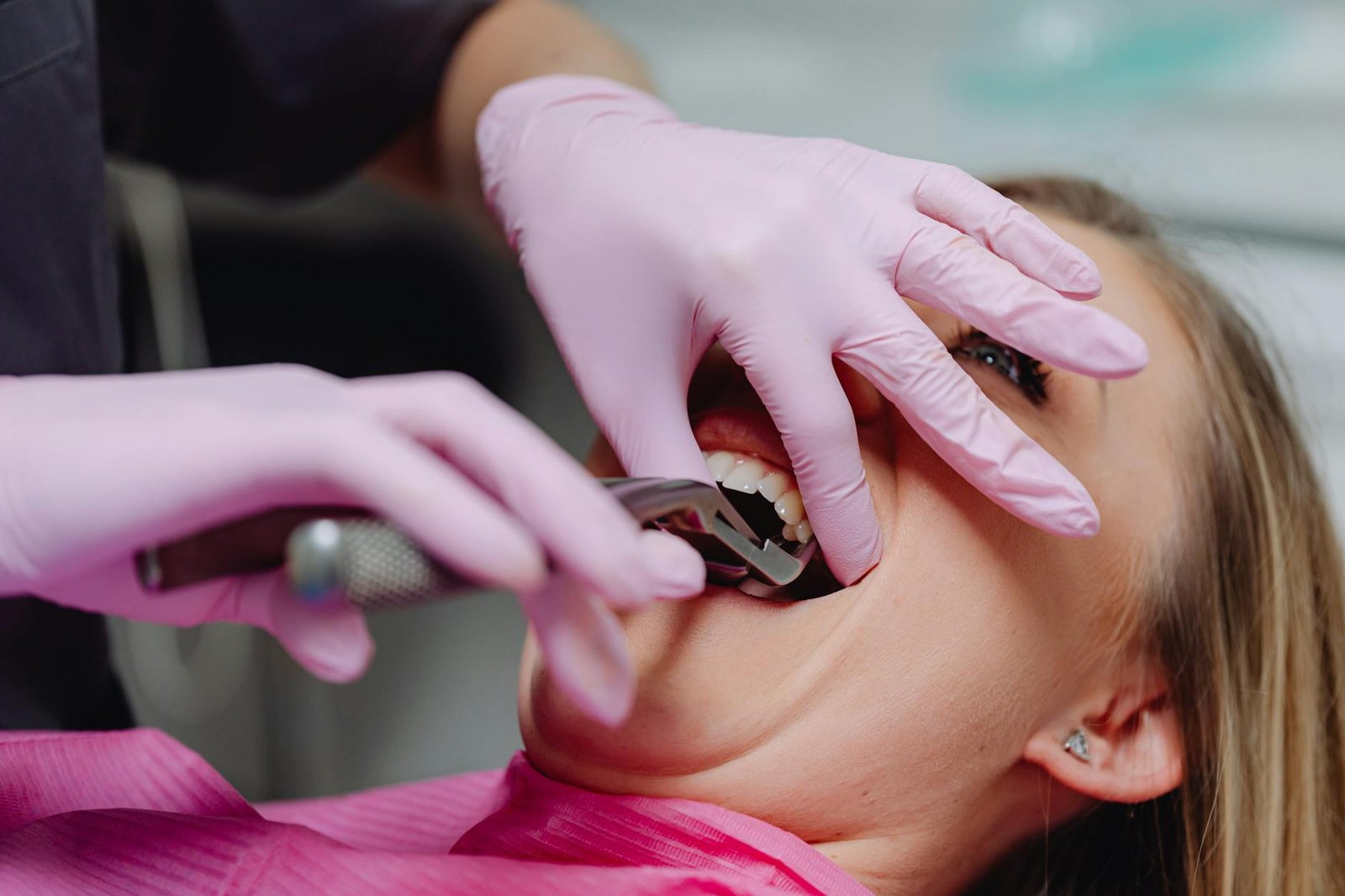 Illustration of Tooth Extraction Hyderabad: Must-Have Guide to Affordable Dental Surgery Near Me